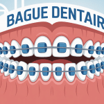 illustration bouche avec bague dentaire et cabinet orthodontie