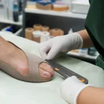 Oignon pied : bosse hallux valgus sur l’avant-pied